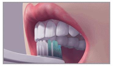 接吻蛀牙会口臭吗,牙齿黄口臭影响接吻吗