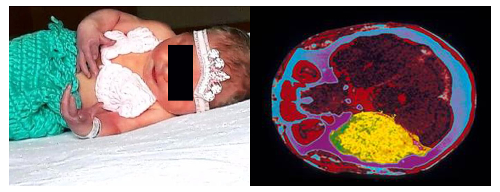 致命一吻加长版,致命一吻1-6完整版解说