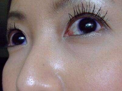 身体湿重吃什么药,身体又痒又湿