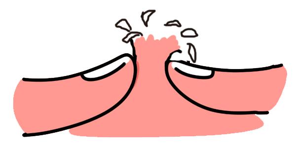 挤痘痘留下痘印多久会好,挤痘痘有哪些危害