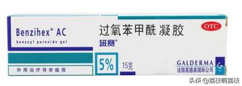 为什么痘痘总是长在同一位置上,同一个位置反复长痘痘怎么治