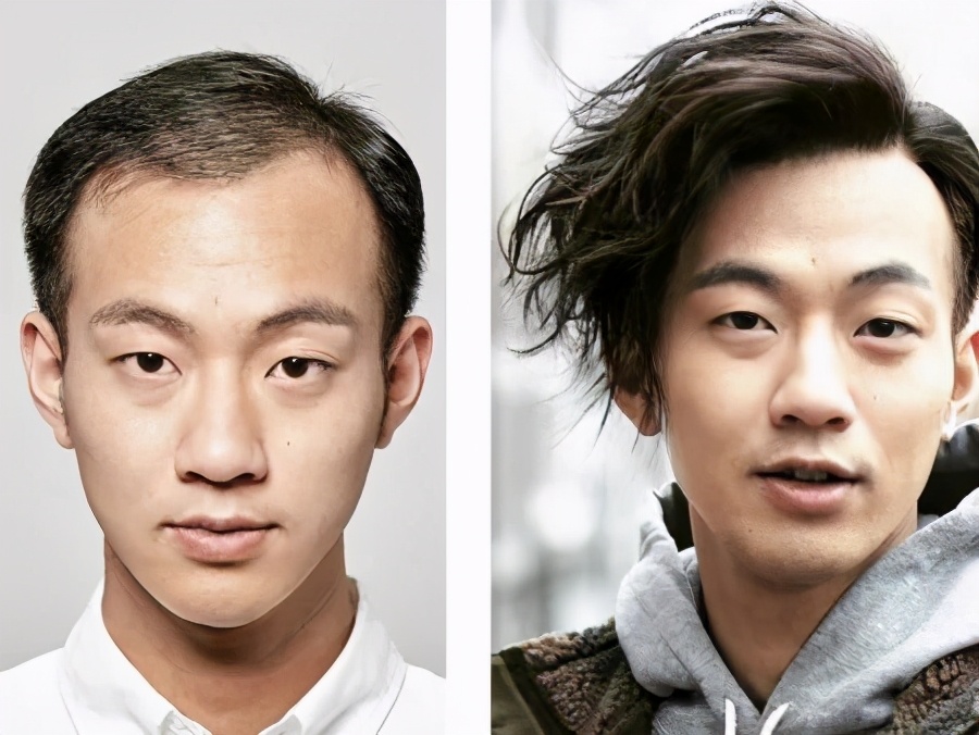 男生发际线太高可以烫发吗,发型设计男生发际线高