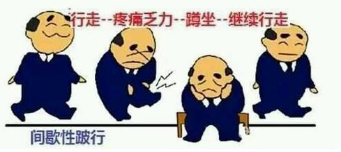 腰椎管狭窄一定要手术才能治好吗,腰椎管狭窄什么情况下可以手术