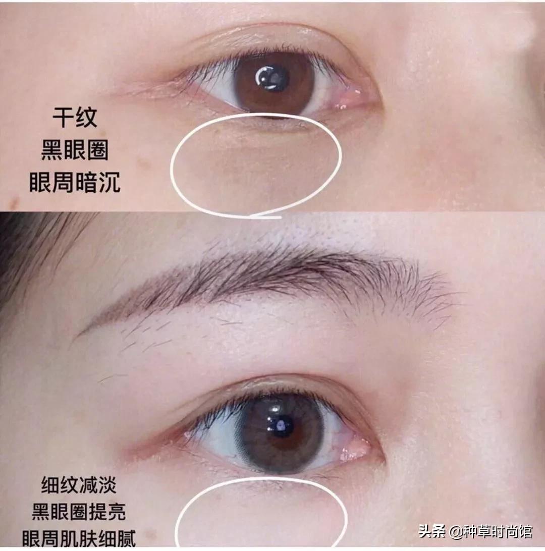 浣犵殑鐪奸湝鏄孩姒滃悧,浣犵殑鐪艰啘鏄笉鏄创閿欎簡