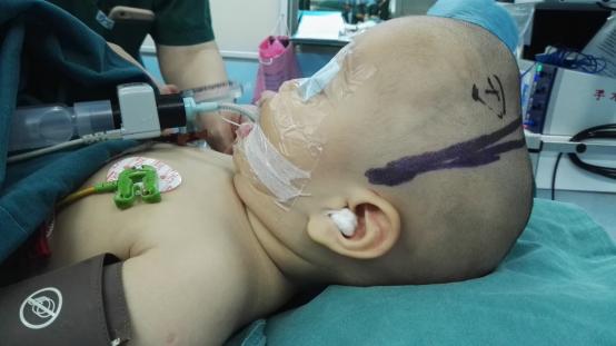 孩子的头偏小怎么办,孩子扁头偏头