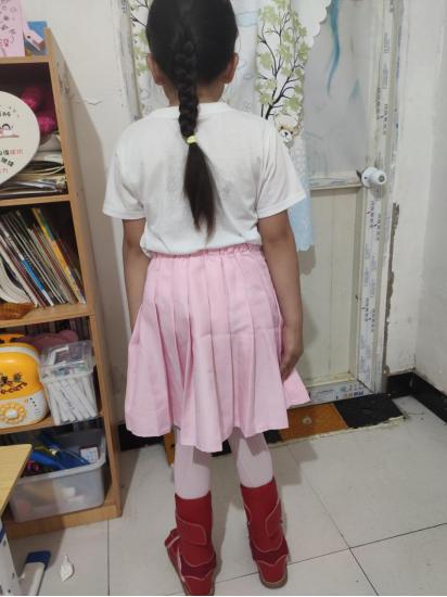 两个小孩患罕见遗传病,2岁女孩患罕见遗传病