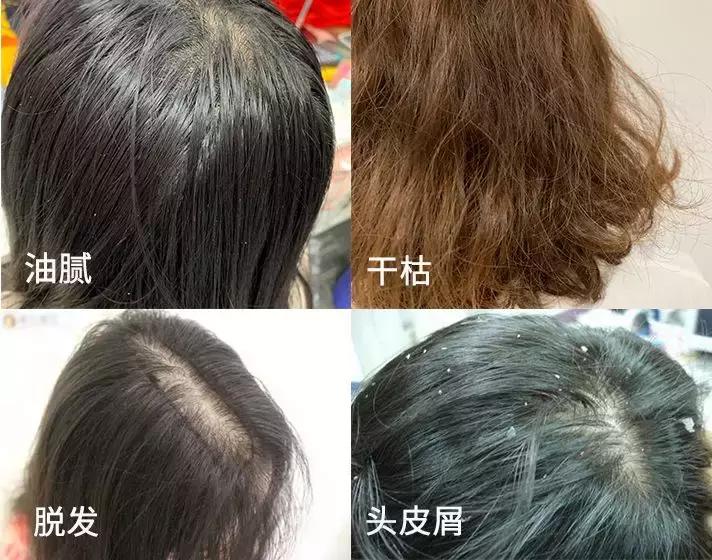 适合清扬的樱花洗发水,明星都在推荐洗发水止痒控油