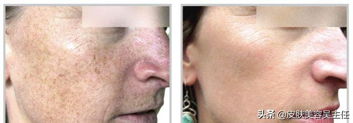 平常人能好看到什么程度,人能漂亮到几岁