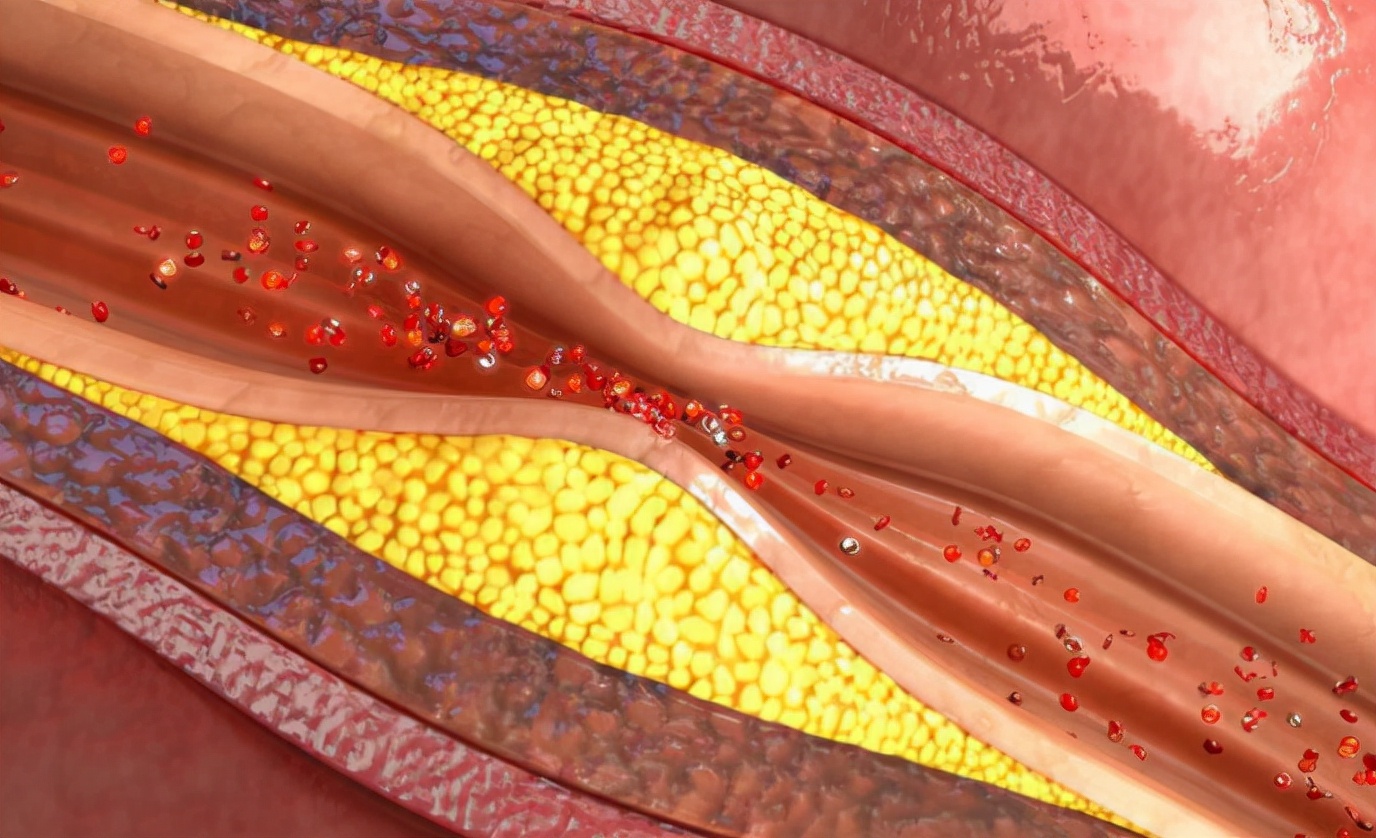 清洗肠道用哪些药,清洗肠道六种食物