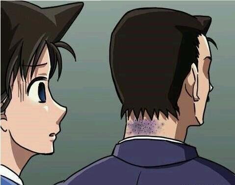 毛利小五郎被柯南踢头,毛利小五郎惩罚柯南的各种方法