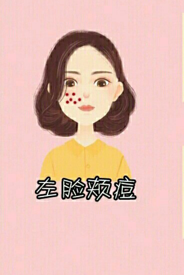 男生脸上各个部位长痘痘图解,脸上不同部位长痘痘的原因