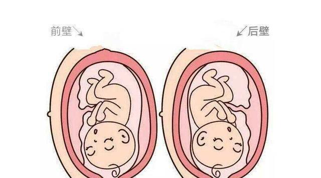 前壁好生还是后壁好生,前壁还是后壁好生
