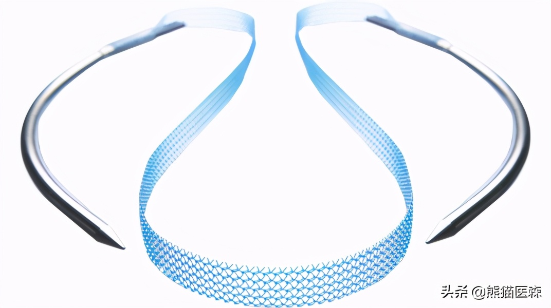 男性吊带手术是小手术吗,吊带手术是什么科做