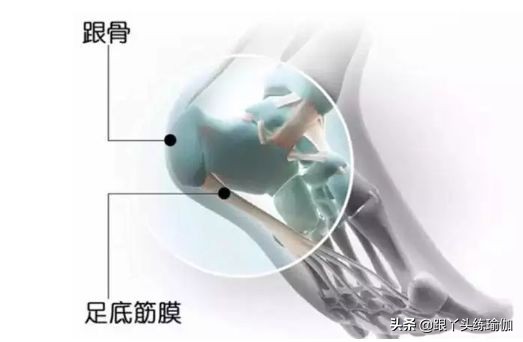 一天走3万步怎么防止足底筋膜炎,每天必须走路怎么治足底筋膜炎