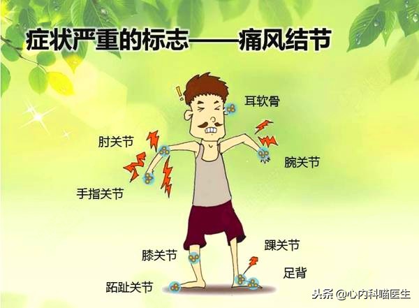 非布司他、别嘌醇—降低尿酸该如何选择？尿酸危害不能忽视！