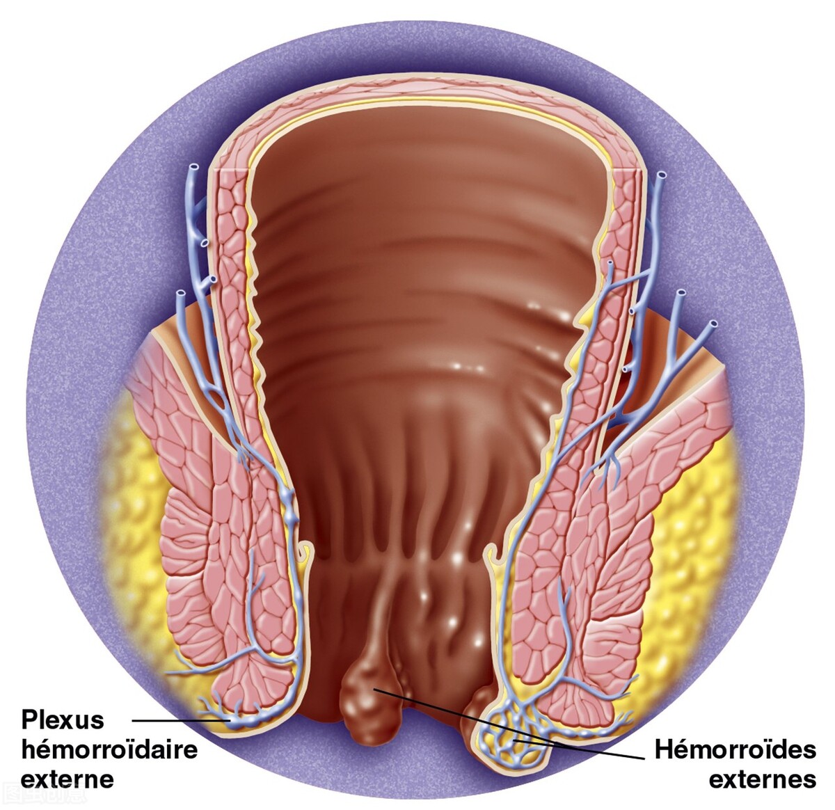 肛门部位的长包是怎么回事？是什么病？