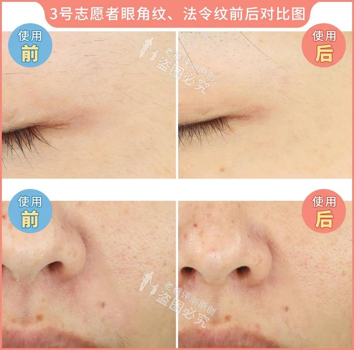 300块的网红美容仪有效果吗,网红家用美容仪测评