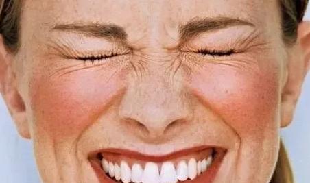 皮肤突然出现一点红血丝怎么回事,皮肤泛红有红血丝的原因