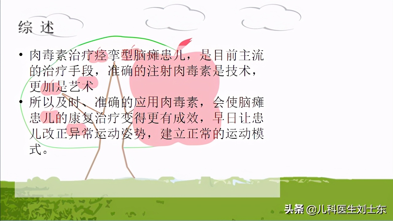 肉毒素治疗脑瘫患儿成功案例,肉毒素治疗脑瘫肌肉痉挛的效果