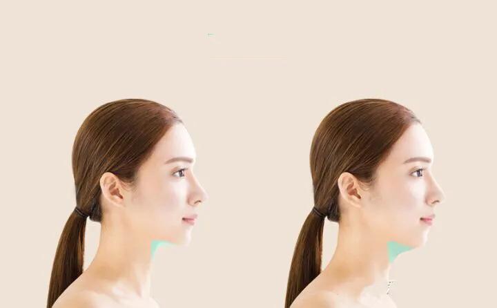 瘦子怎么会有双下巴,两个动作7天瘦掉双下巴