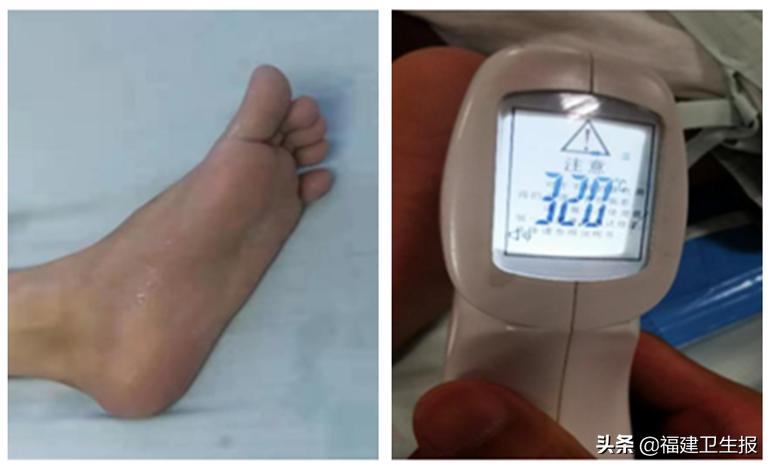 福建一男子醒来腰酸背痛,男子发烧40度汗水湿透床