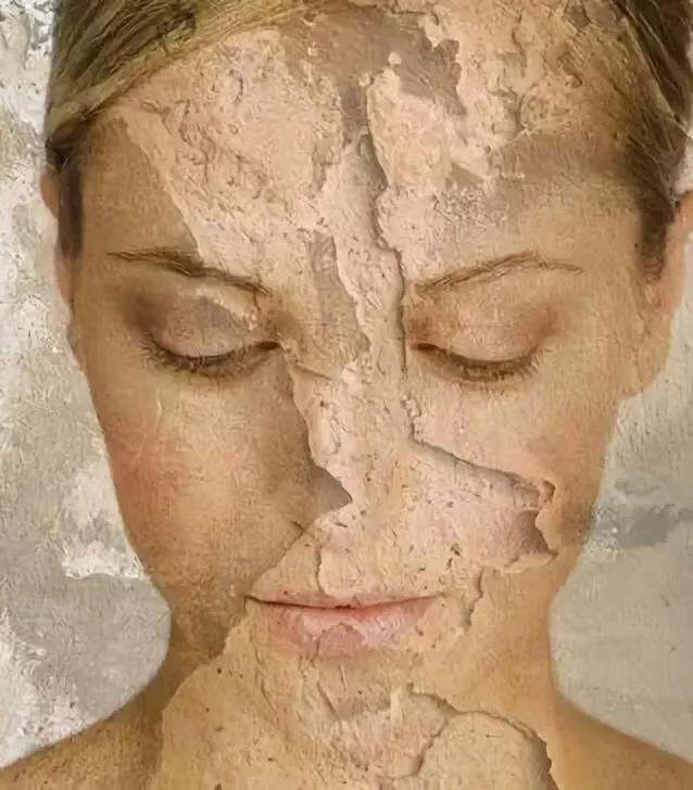 擦护肤品后疼怎么办,用完维a酸乳膏后擦护肤品刺痛