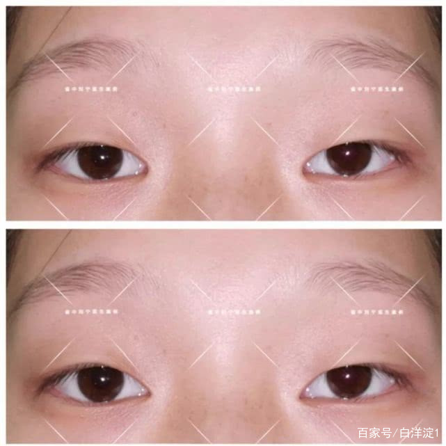 名门泽佳的正确涂法,名门泽佳祛皱小细节