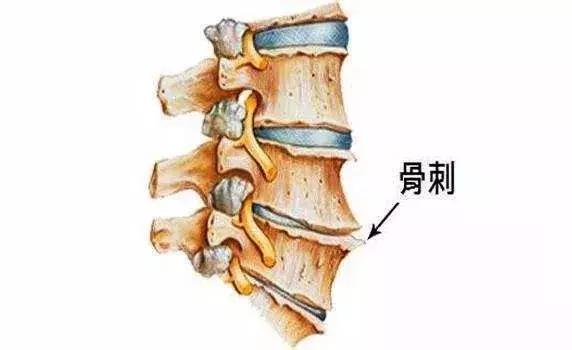 腰疼直不起来腰是什么原因引起的,青少年两侧腰疼是什么原因引起的