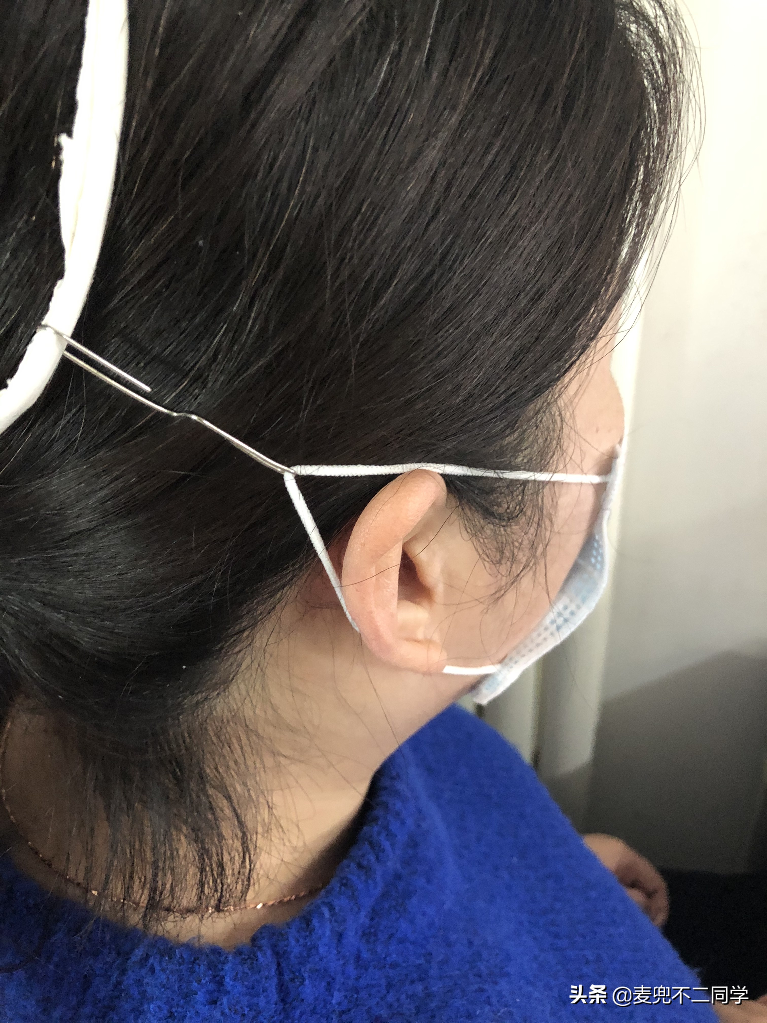 n95口罩勒的耳朵疼怎么解决,口罩戴久了耳朵疼怎么办