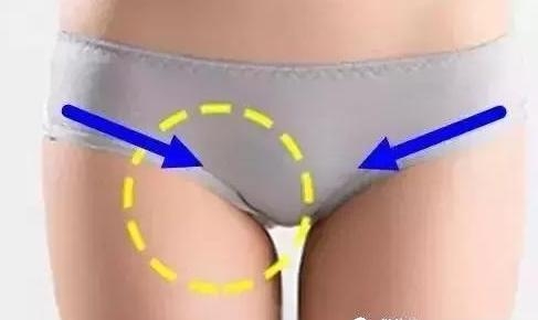 大腿根部摸到一个小包块，居然是癌症晚期，这个病例值得我们深思