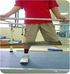 简单的截肢方法,截肢物理治疗