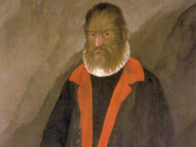 金毛狮王头发是什么根,金毛狮王的头发怎么处理