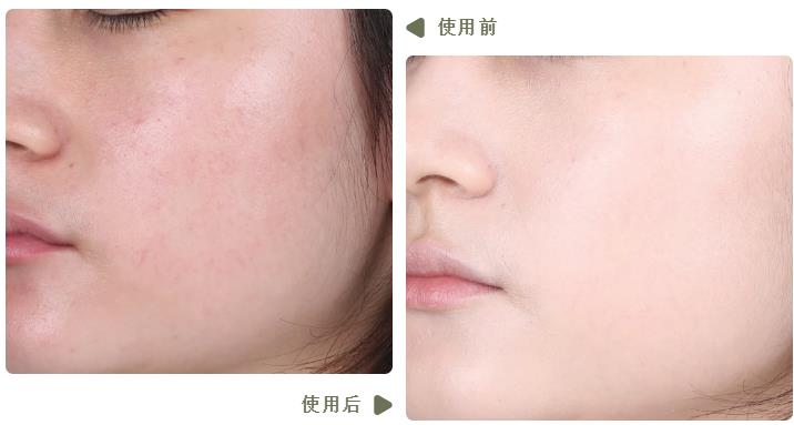 测大牌气垫,五款大热气垫真实测评