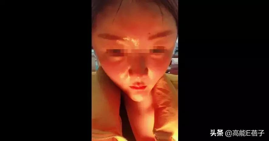 微整形需要多久,微整形后多久恢复正常