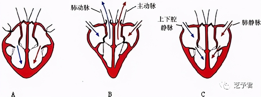 醋泡大蒜的功效对高血压有帮助吗,大蒜治高血压的做法