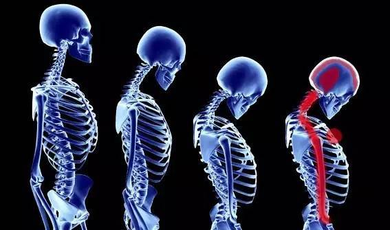 颈椎引起的头晕怎么办最有效方法,颈椎引起头晕吃什么药好得快