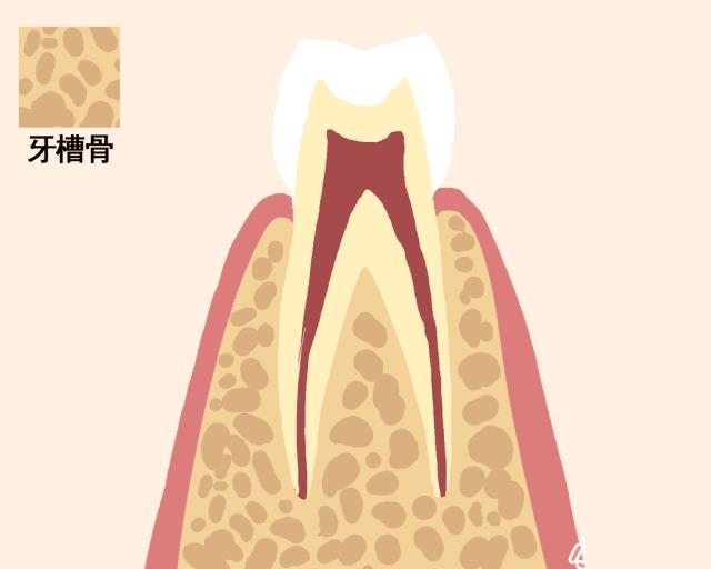 牙齿摔松动怎么办,牙齿松动恢复秘方