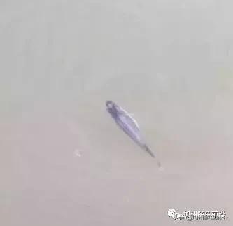 加州鲈鱼如何防治,加州鲈鱼熟身病防治方法