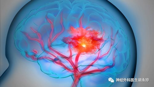 脑出血后肢体功能障碍还能恢复吗,脑出血后能恢复做饭功能吗