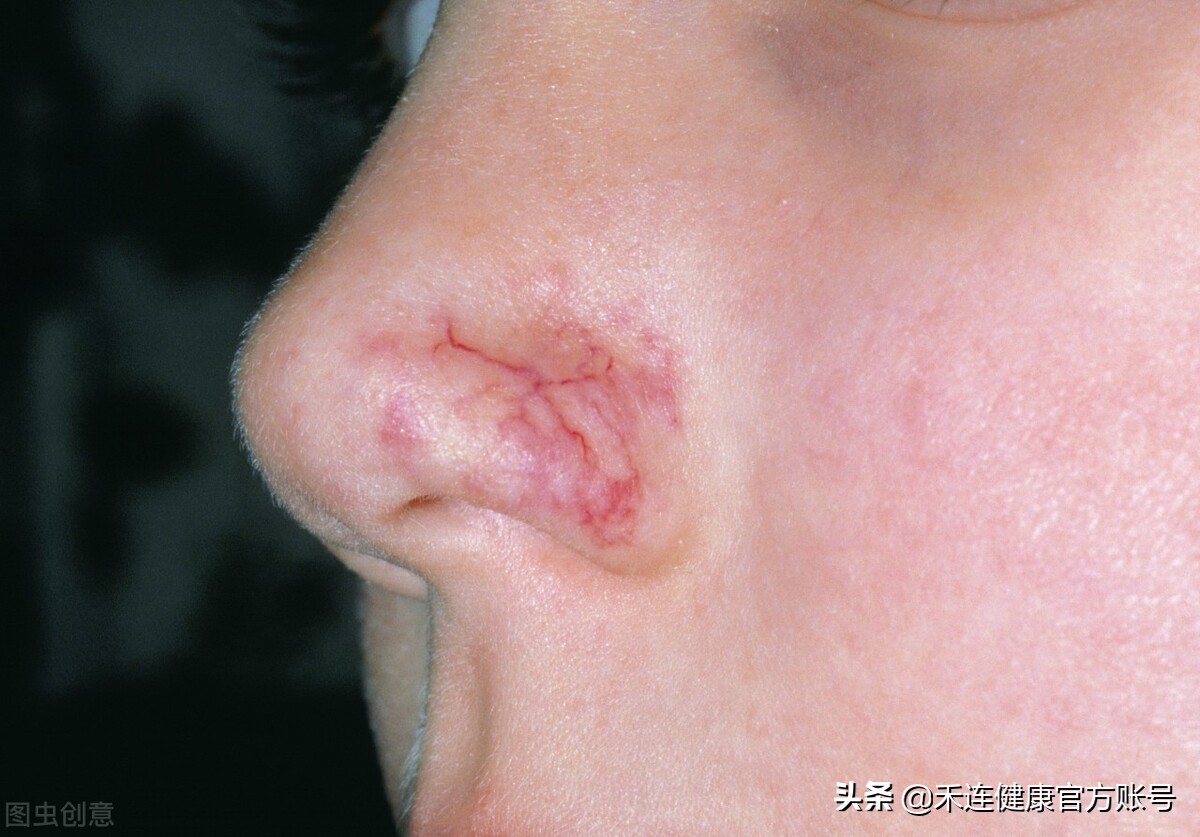 身上长小红点是肝不好吗,肝出什么问题身上会有小红点