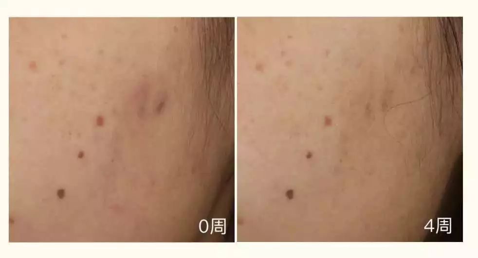 这些大牌护肤品真的值得买吗,盘点平价国货不输大牌护肤品