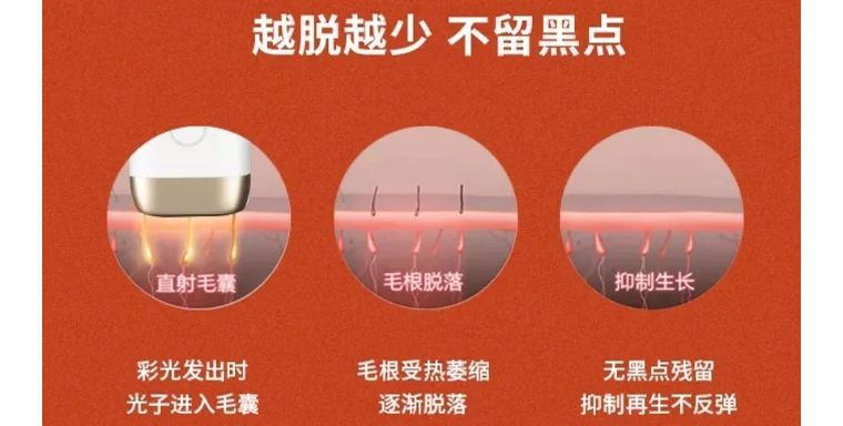 j-style冰点脱毛仪,j-style光子嫩肤脱毛仪