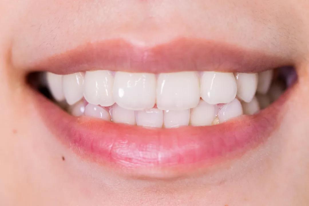 护牙釉质的牙膏叫什么牙膏,防蛀牙牙膏推荐前十名儿童