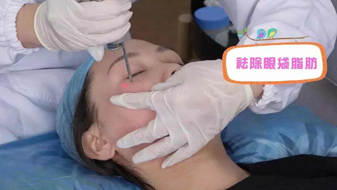 去眼袋15年后有细纹怎么办,祛眼袋之后会不会看着很平