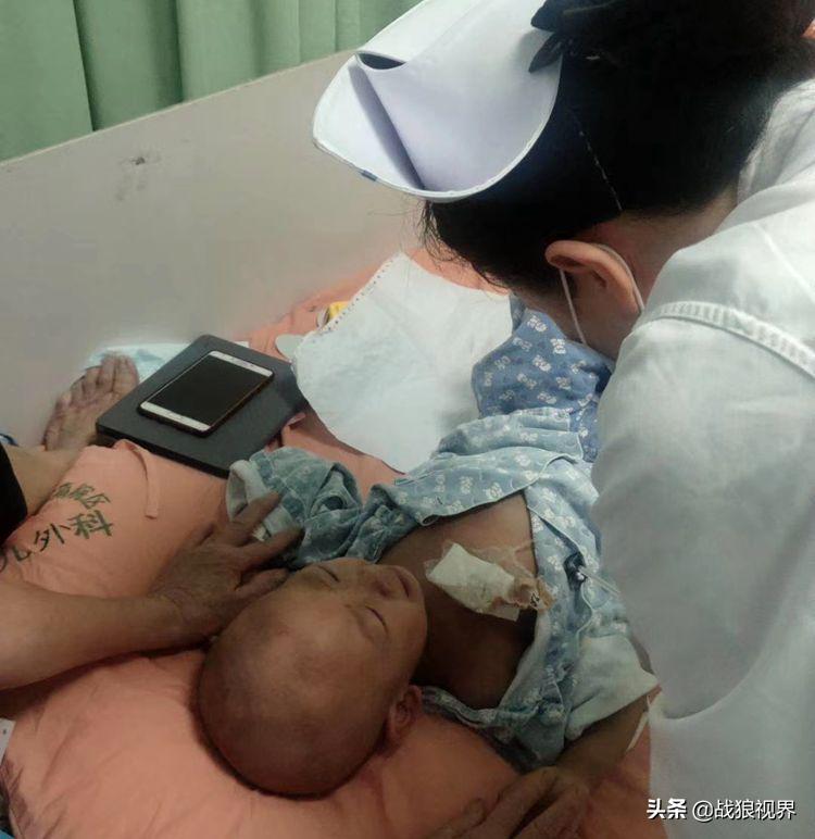 小孩摔一跤后引起眼袋淤青,2岁多男宝眼袋浮肿有点发紫