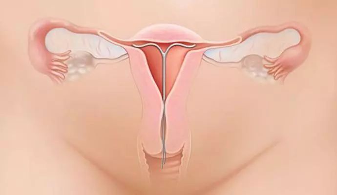 吃了紧急避孕药怀孕可能性有多大,紧急避孕药吃了怀孕的几率有多大