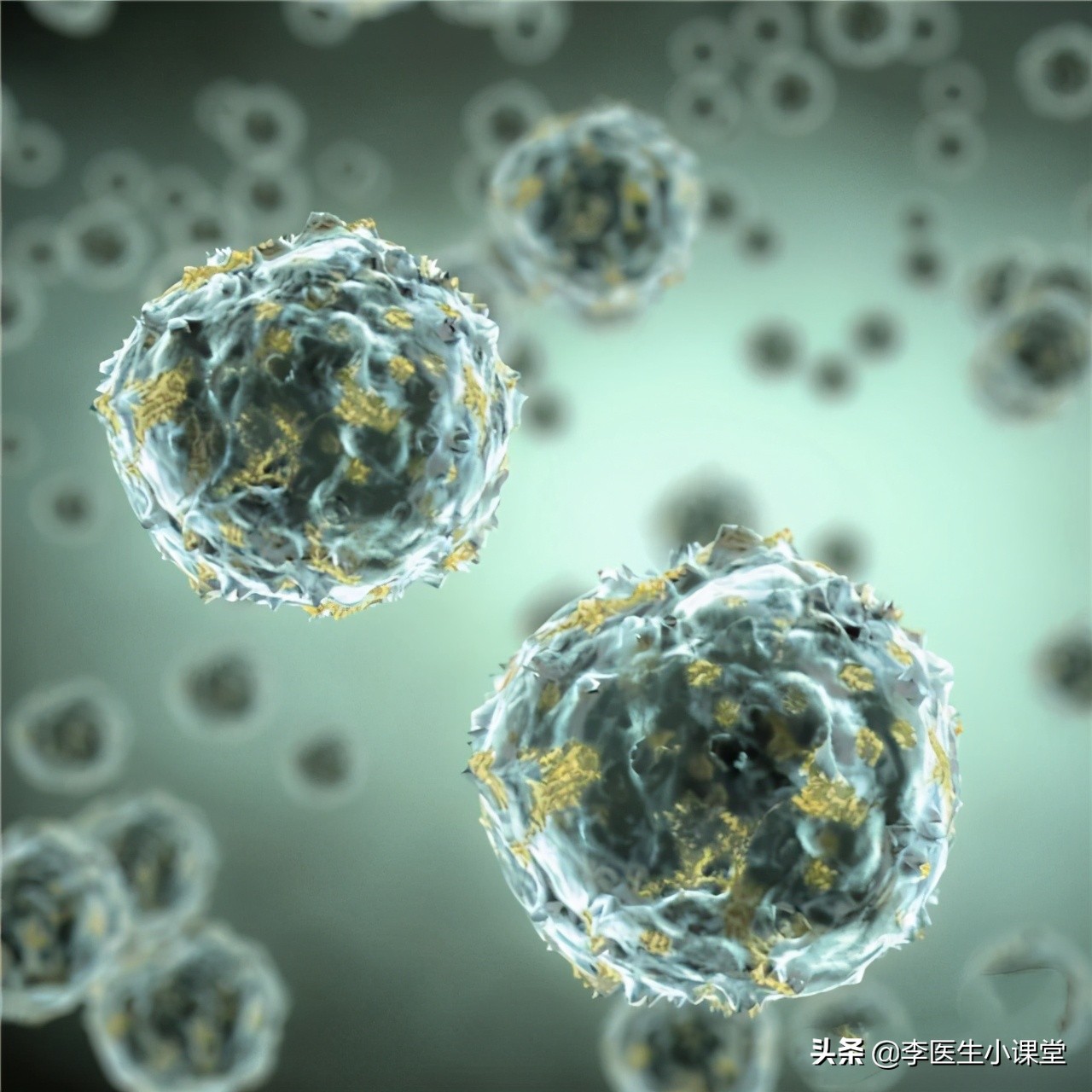 从炎症到癌症多长时间,炎症一般多久发展成癌症