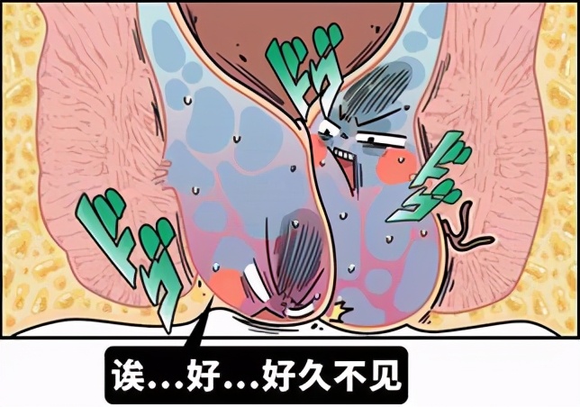 痔疮发展到哪个阶段可以考虑手术,痔疮手术看似简单