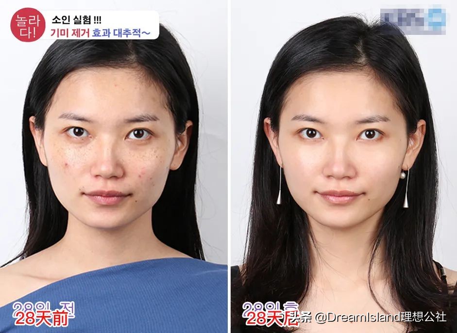 50岁冻龄妈妈有做医美吗,冻龄阿姨保养秘诀