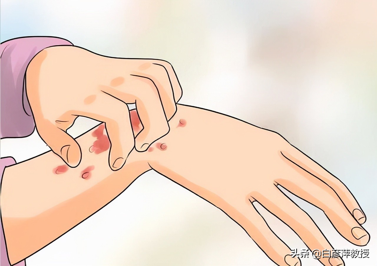 皮肤瘙痒红肿有风团,皮疹伴疼痛的皮肤病